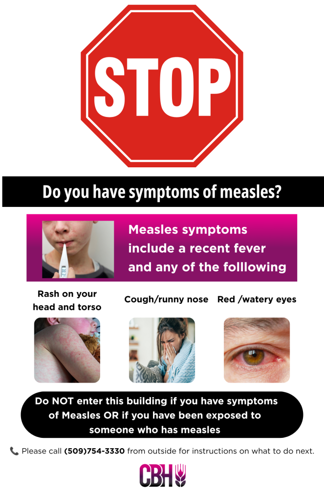 Measles